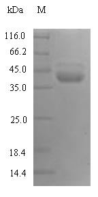 KLKB1 / Plasma Kallikrein Protein - (Tris-Glycine gel) Discontinuous SDS-PAGE (reduced) with 5% enrichment gel and 15% separation gel.