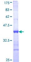 Klra1 / Ly49 Protein - 12.5% SDS-PAGE Stained with Coomassie Blue.