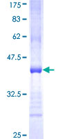 KLRB1 / CD161 Protein - 12.5% SDS-PAGE Stained with Coomassie Blue.