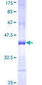 KLRB1 / CD161 Protein - 12.5% SDS-PAGE Stained with Coomassie Blue.