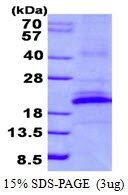 KLRB1 / CD161 Protein