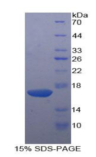 KLRB1 / CD161 Protein - Recombinant Killer Cell Lectin Like Receptor Subfamily B, Member 1 By SDS-PAGE