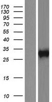 KLRC1 / NKG2A / CD159a Protein - Western validation with an anti-DDK antibody * L: Control HEK293 lysate R: Over-expression lysate