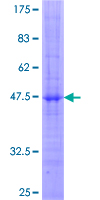 KLRC1 / NKG2A / CD159a Protein - 12.5% SDS-PAGE of human KLRC1 stained with Coomassie Blue