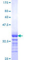 KLRC1 / NKG2A / CD159a Protein - 12.5% SDS-PAGE Stained with Coomassie Blue.