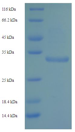 KLRC2 / NKG2C / CD159c Protein
