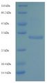 KLRC2 / NKG2C / CD159c Protein