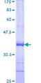 KLRC3 / NKG2E Protein - 12.5% SDS-PAGE Stained with Coomassie Blue.