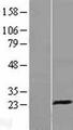 KLRD1 / CD94 Protein - Western validation with an anti-DDK antibody * L: Control HEK293 lysate R: Over-expression lysate