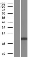 KLRD1 / CD94 Protein - Western validation with an anti-DDK antibody * L: Control HEK293 lysate R: Over-expression lysate
