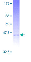 KLRD1 / CD94 Protein - 12.5% SDS-PAGE of human KLRD1 stained with Coomassie Blue