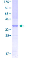 KLRD1 / CD94 Protein - 12.5% SDS-PAGE Stained with Coomassie Blue.