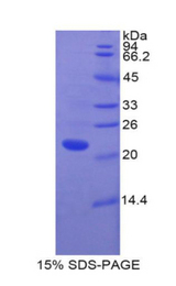 KLRD1 / CD94 Protein