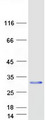 KLRD1 / CD94 Protein - Purified recombinant protein KLRD1 was analyzed by SDS-PAGE gel and Coomassie Blue Staining