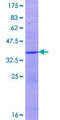 KLRF1 Protein - 12.5% SDS-PAGE of human KLRF1 stained with Coomassie Blue