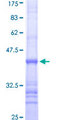 KLRF1 Protein - 12.5% SDS-PAGE Stained with Coomassie Blue.