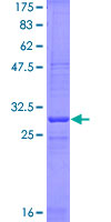 KLRG1 Protein - 12.5% SDS-PAGE Stained with Coomassie Blue.