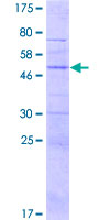 KLRK1 / CD314 / NKG2D Protein - 12.5% SDS-PAGE of human KLRK1 stained with Coomassie Blue