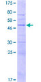 KLRK1 / CD314 / NKG2D Protein - 12.5% SDS-PAGE of human KLRK1 stained with Coomassie Blue