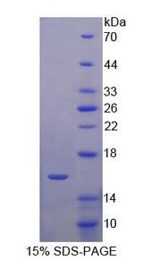 KLRK1 / CD314 / NKG2D Protein - Recombinant Killer Cell Lectin Like Receptor Subfamily K, Member 1 By SDS-PAGE
