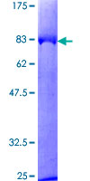 KNG1 / Kininogen / Bradykinin Protein - 12.5% SDS-PAGE of human KNG1 stained with Coomassie Blue