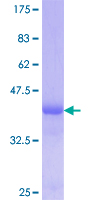 KNG1 / Kininogen / Bradykinin Protein - 12.5% SDS-PAGE Stained with Coomassie Blue.