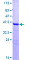 KPI-2 / LMTK2 Protein - 12.5% SDS-PAGE Stained with Coomassie Blue.