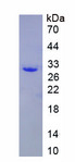 KPNA1 / Importin Alpha 5 Protein - Recombinant Karyopherin Alpha 1 By SDS-PAGE