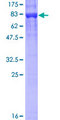 KPNA1 / Importin Alpha 5 Protein - 12.5% SDS-PAGE of human KPNA1 stained with Coomassie Blue
