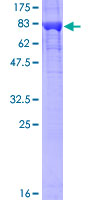 KPNA2 / Importin Alpha 1 Protein - 12.5% SDS-PAGE of human KPNA2 stained with Coomassie Blue