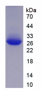 KPNA2 / Importin Alpha 1 Protein - Recombinant Karyopherin Alpha 2 By SDS-PAGE