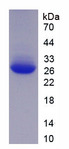 KPNA2 / Importin Alpha 1 Protein - Recombinant Karyopherin Alpha 2 By SDS-PAGE