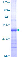 KPNA3 / Importin Alpha 4 Protein - 12.5% SDS-PAGE Stained with Coomassie Blue.