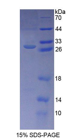 KPNA3 / Importin Alpha 4 Protein - Recombinant  Karyopherin Alpha 3 By SDS-PAGE