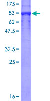 KPNA5 Protein - 12.5% SDS-PAGE of human KPNA5 stained with Coomassie Blue