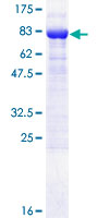 KPNA6 Protein - 12.5% SDS-PAGE of human KPNA6 stained with Coomassie Blue