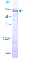 KPTN / Kaptin Protein - 12.5% SDS-PAGE of human KPTN stained with Coomassie Blue