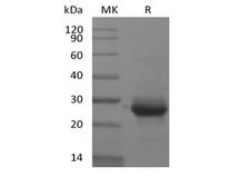 KRAS Protein - Recombinant Human KRAS(G12V, N-6His)