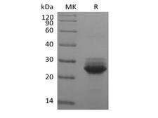 KRAS Protein - Recombinant Human KRAS(G12S, N-6His)