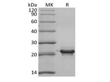 KRAS Protein - Recombinant Human KRAS4B (N-6His)