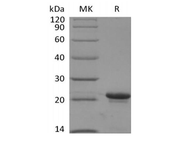KRAS Protein - Recombinant Human KRAS4B(G12V, N-6His)