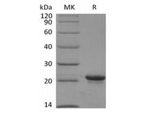 KRAS Protein - Recombinant Human KRAS4B(G12V, N-6His)
