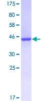 KRAS Protein - 12.5% SDS-PAGE of human KRAS stained with Coomassie Blue