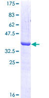KRAS Protein - 12.5% SDS-PAGE Stained with Coomassie Blue.