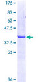 KRAS Protein - 12.5% SDS-PAGE Stained with Coomassie Blue.
