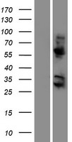 KRBA2 Protein - Western validation with an anti-DDK antibody * L: Control HEK293 lysate R: Over-expression lysate