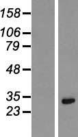 KRCC1 Protein - Western validation with an anti-DDK antibody * L: Control HEK293 lysate R: Over-expression lysate