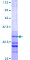 KREMEN1 / KREMEN-1 Protein - 12.5% SDS-PAGE Stained with Coomassie Blue.