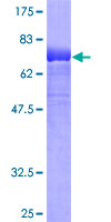 KREMEN2 Protein - 12.5% SDS-PAGE of human KREMEN2 stained with Coomassie Blue