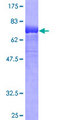 KREMEN2 Protein - 12.5% SDS-PAGE of human KREMEN2 stained with Coomassie Blue